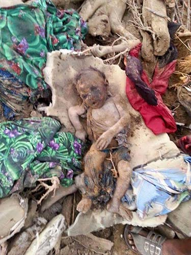 Saudi Aggression on Yemeni Children 