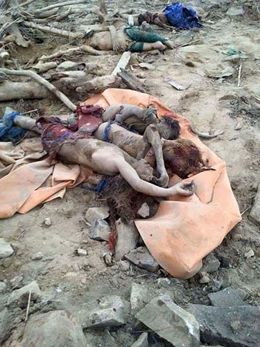 Saudi Aggression on Yemeni Children 