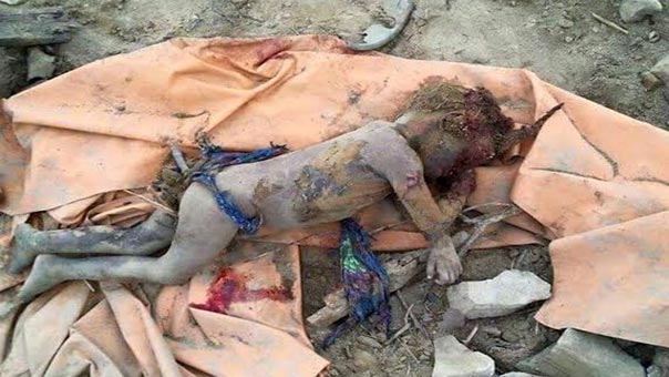 Saudi Aggression on Yemeni Children 