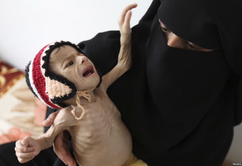 Famine Stalks Yemen: Growing Catastrophic Food Crisis