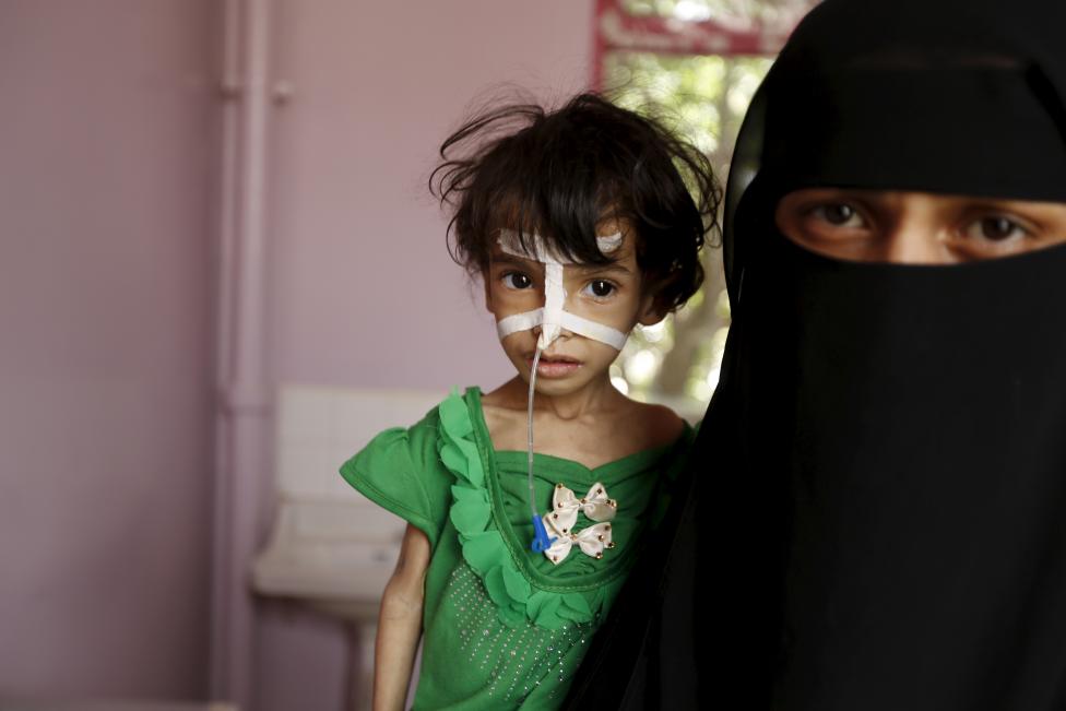  Merciless Saudi Aggression: Going Hungry in Yemen