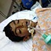 Bahraini Child in Coma due to Police Tear Gas