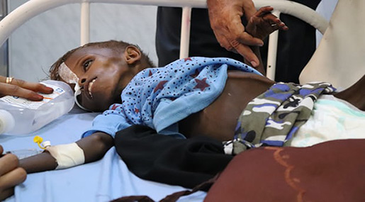Only God Can Save Us: Yemen Blockade May Cause World’s Largest Famine In Decades