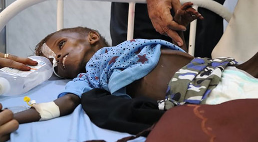 WFP Fears More Yemen Deaths amid Blockade