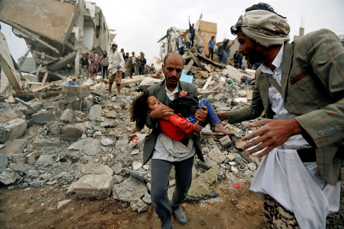 More than a 1000 Days of War on Yemen [Photos]