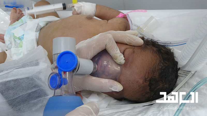 Record Embryological Malformation in Yemen Due to The Saudi Use of Internationally Prohibited Weapons
