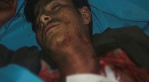 Yemeni victim of Saudi-led agression 