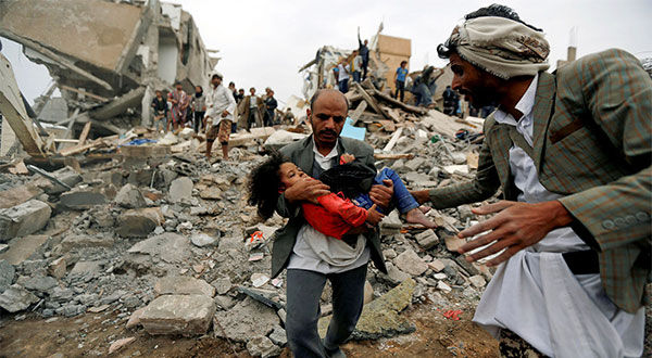 More than a 1000 Days of War on Yemen [Photos]