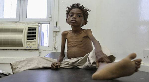 Yemeni child 