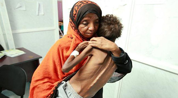 Yemeni mother and her child