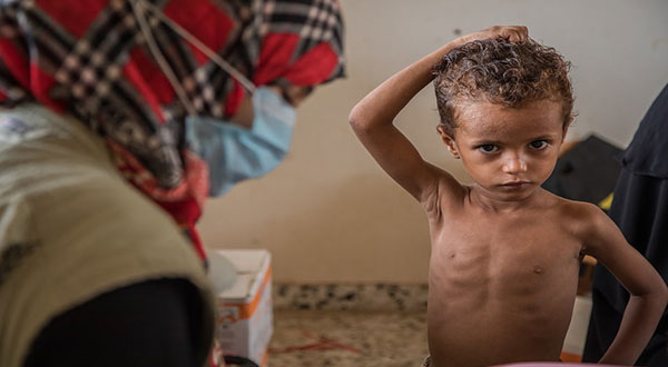 Yemen Cholera Outbreak [Photos]