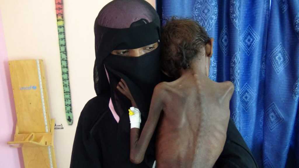 Mothers Must Decide Which Child Survives In Devastating Yemen Crisis