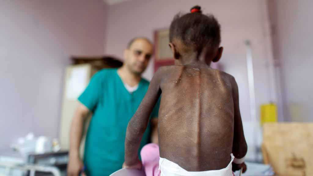 Oxfam: Yemen Risks «Massive Resurgence» of Cholera