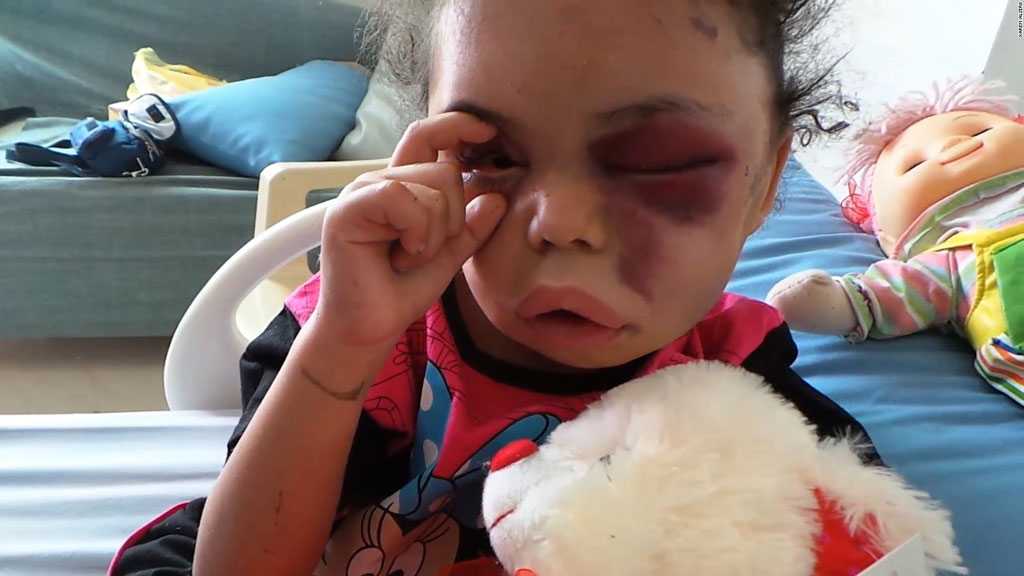 Yemeni Children’s Plight Deepens as Globe Marks World Children’s Day