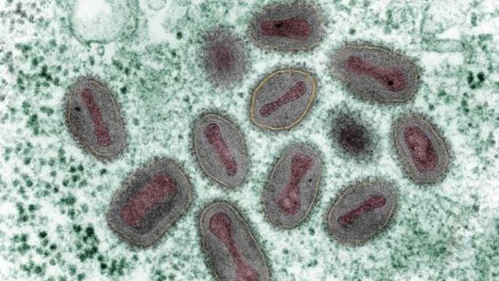 FBI & CDC Investigate ‘Smallpox’ Vials at Big Pharma Facility