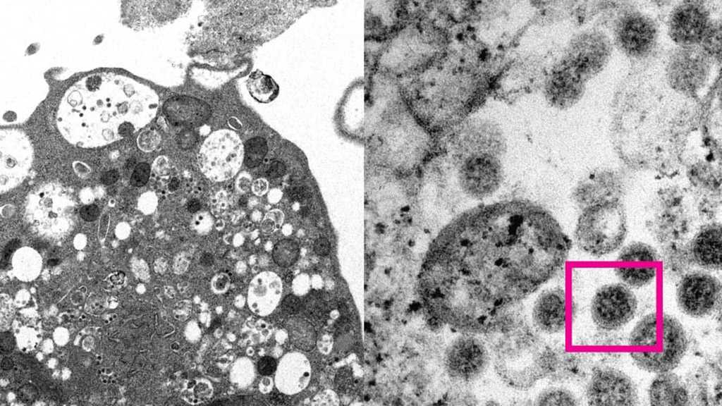 New Omicron Subvariant Is More Infectious, More Puzzling COVID Strain