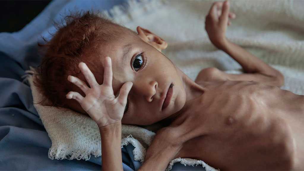 Yemen Can’t Wait: WFP Unable To Provide 13 Million Yemenis with Food Aid