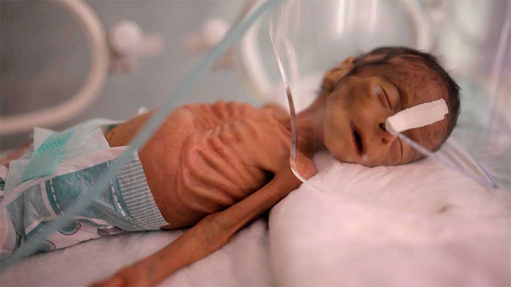 13 Million Yemenis May Face Starvation, UN Food Agency Warns