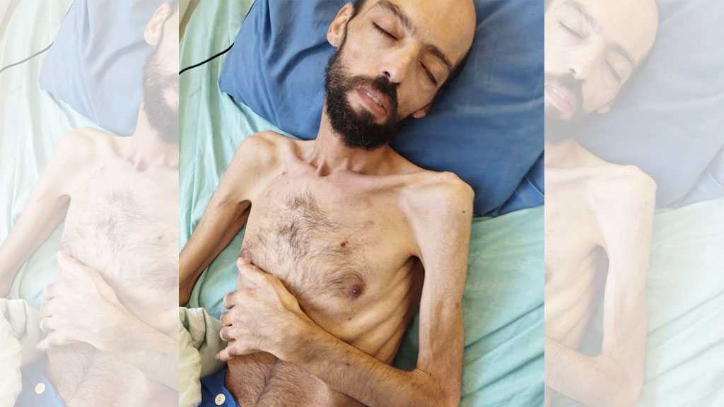 EU Shocked by Pictures of Nothing More Than Skin, Bones of Palestinian Hunger-striking Detainee