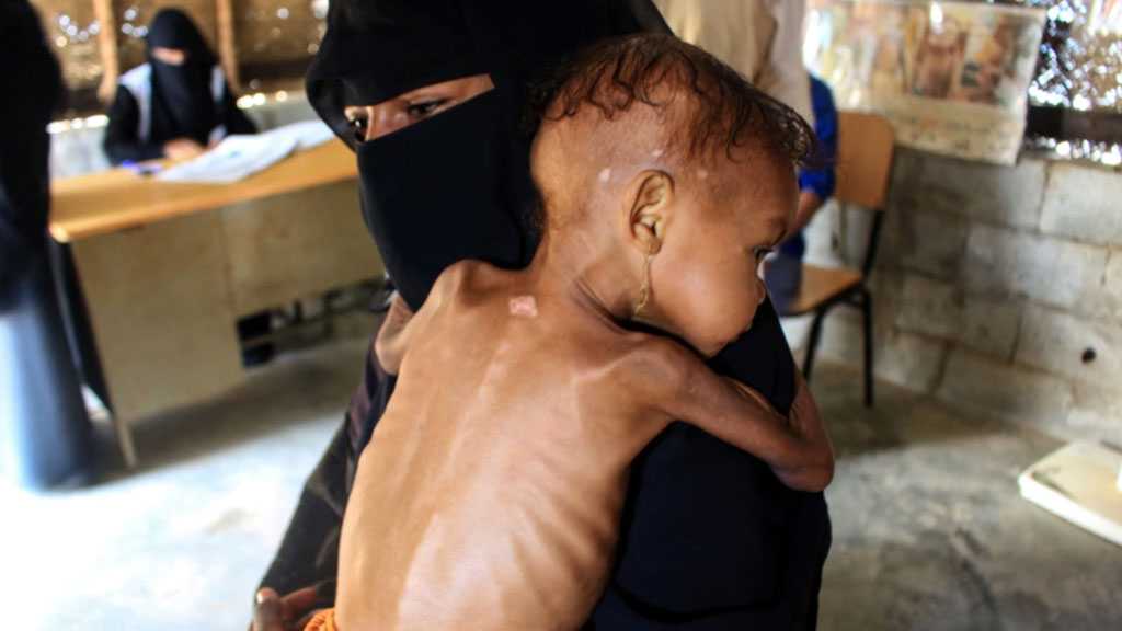 Yemen Can’t Wait: 19 million Suffer Food Insecurity as Saudi Siege Continues