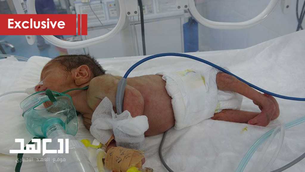 Record Embryological Malformation in Yemen Due to The Saudi Use of Internationally Prohibited Weapons