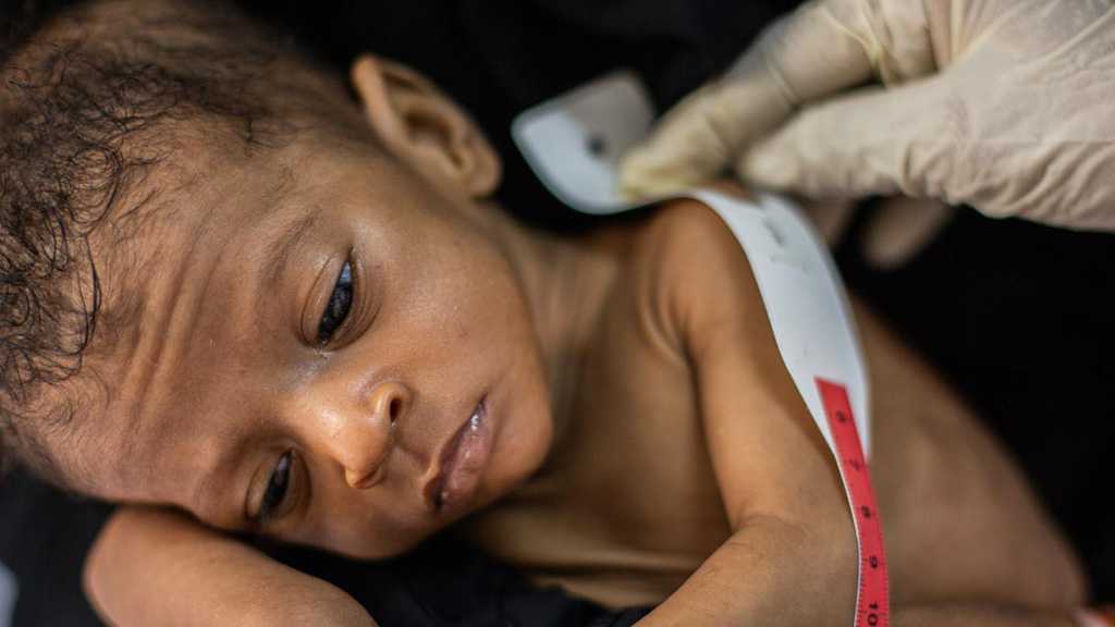 UNICEF: Millions of Children at Risk of Malnutrition in Yemen