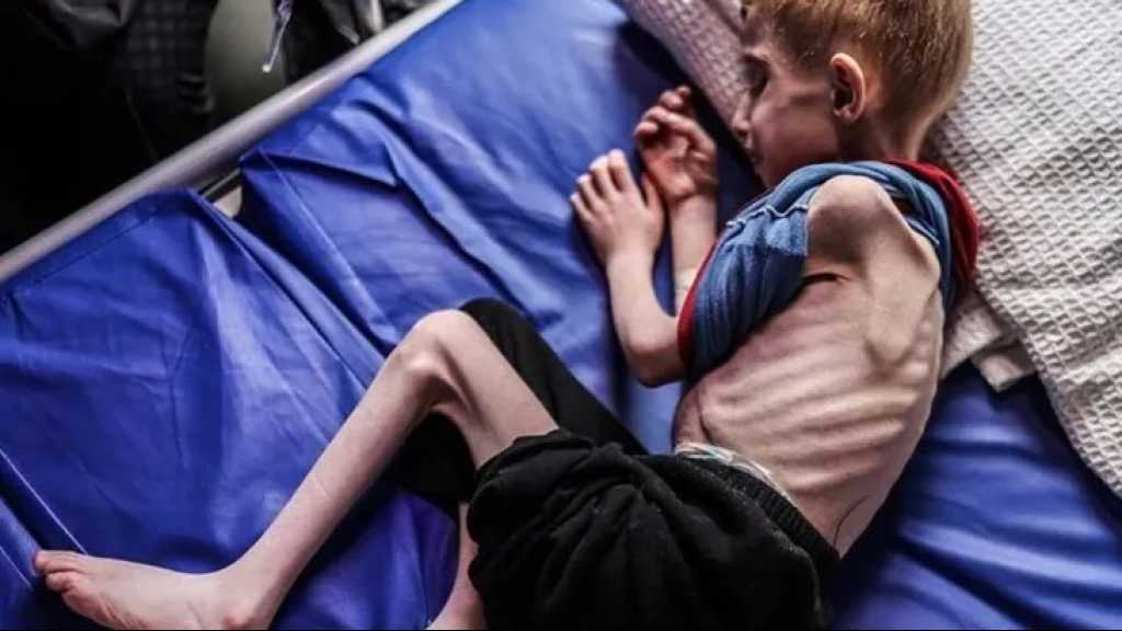 Malnutrition Plagues Palestinian Children in Gaza
