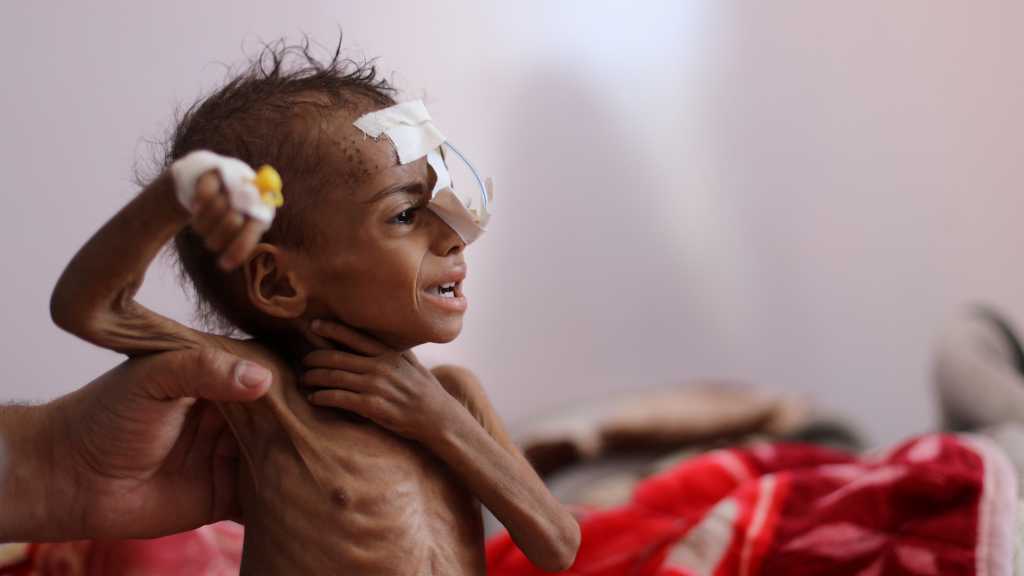 UNICEF: Western Coastal Areas of Yemen Near Catastrophe Due to Malnutrition